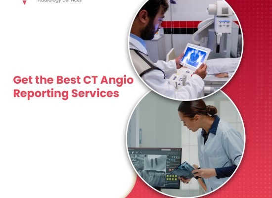 Get the Best CT Angio Reporting Services