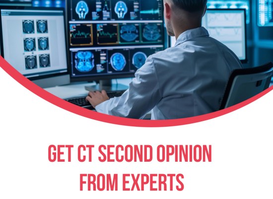 Get CT Second Opinion from Experts