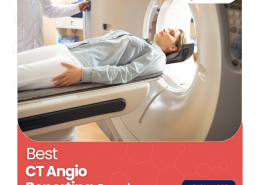 Best CT Angio Reporting Services