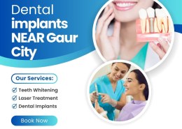 Affordable Dental Implants NEAR Gaur City for Missing Teeth